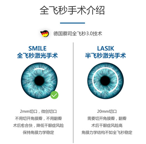 全飞秒近视眼手术是什么原理？杭州全飞秒激光矫正多少钱？