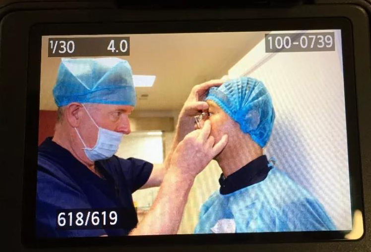 近视眼术前术后的注意事项