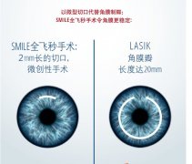 ICL手术哪些人可以做？