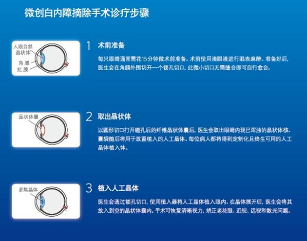 北京无刀飞秒激光白内障手术
