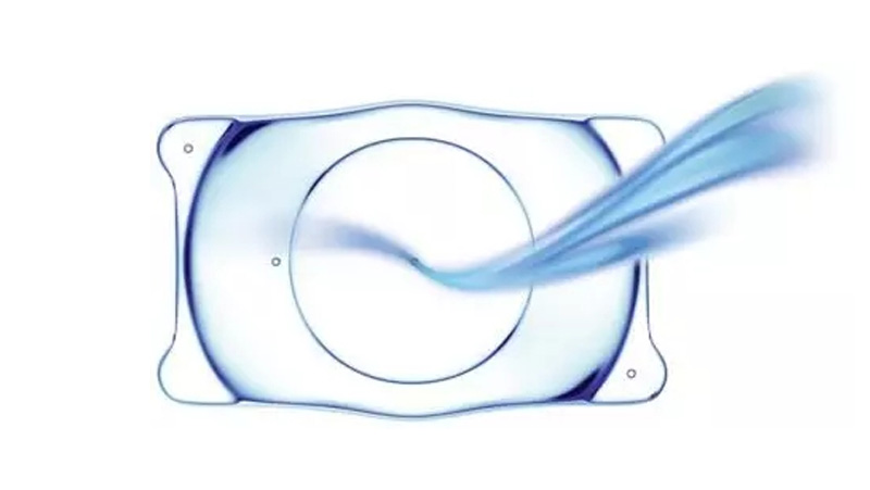 不用摘的隐形眼镜，ICL晶体植入术有哪些原理和优势？