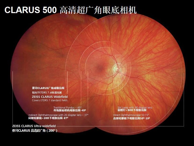蔡司 CLARUS 500