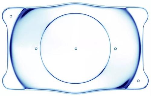 激光近视手术和晶体植入术哪个好