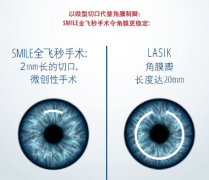 北京近视600度可以矫正吗？