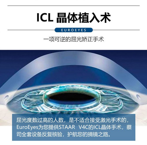 高度近视能做激光手术吗？ ICL晶体手术杭州哪家医院好？